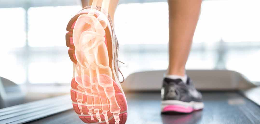 Ein Laufbandtest zeigt die Fußbelastung - wichtig vor dem Schuhekauf
